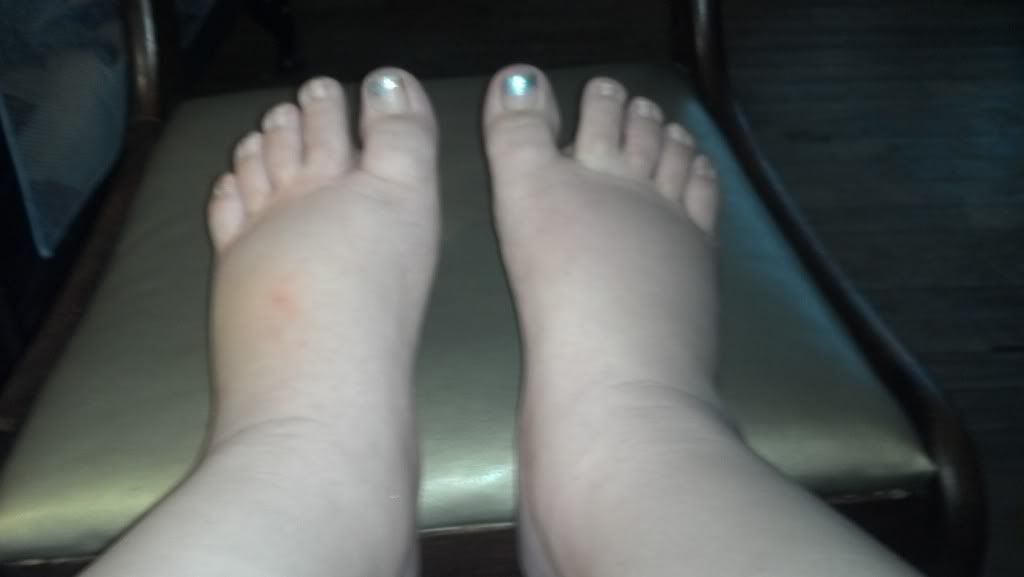 pregnancy-38-weeks-and-swollen-anyone-seen-my-feet-today-s-parent